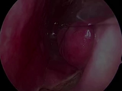 Disposable Ultra-small and Flexible Neurology Probe PLA407